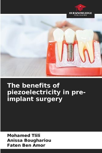 Cover image for The benefits of piezoelectricity in pre-implant surgery