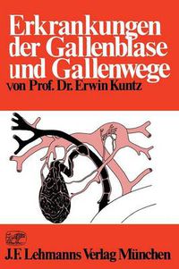 Cover image for Erkrankungen Der Gallenblase Und Gallenwege