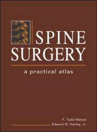 Cover image for Spine Surgery: A Practical Atlas