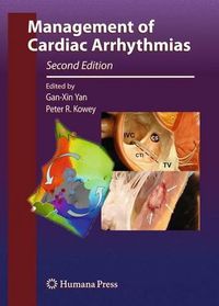 Cover image for Management of Cardiac Arrhythmias