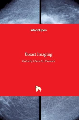 Cover image for Breast Imaging