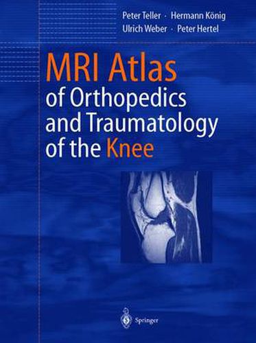 Cover image for MRI Atlas of Orthopedics and Traumatology of the Knee