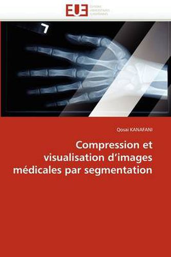 Cover image for Compression Et Visualisation D'Images M Dicales Par Segmentation