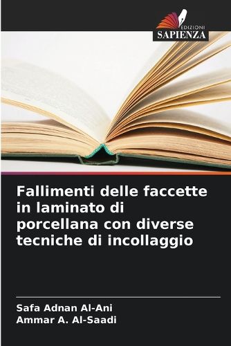 Cover image for Fallimenti delle faccette in laminato di porcellana con diverse tecniche di incollaggio