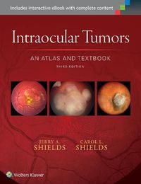 Cover image for Intraocular Tumors: An Atlas and Textbook