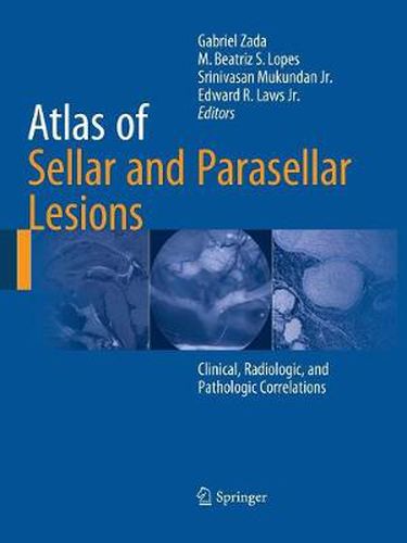 Cover image for Atlas of Sellar and Parasellar Lesions: Clinical, Radiologic, and Pathologic Correlations