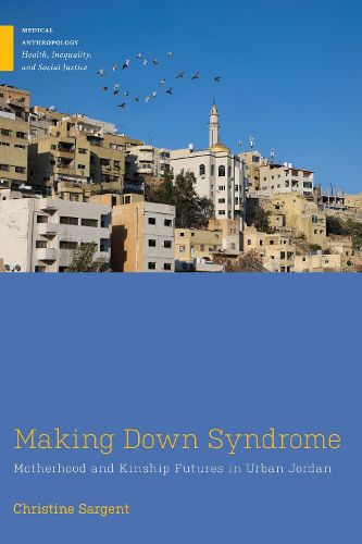 Cover image for Making Down Syndrome