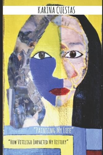 Cover image for " Painting My Life" " How Vitiligo Impacted my history."