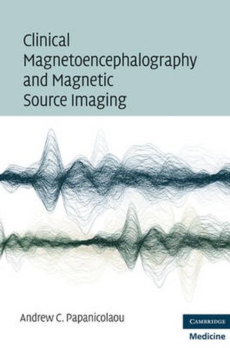 Cover image for Clinical Magnetoencephalography and Magnetic Source Imaging