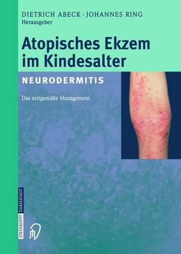 Cover image for Atopisches Ekzem Im Kindesalter (Neurodermitis): Zeitgemaaes Management