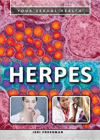 Cover image for Herpes