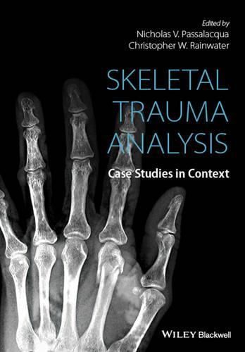 Skeletal Trauma Analysis - Case Studies in Context