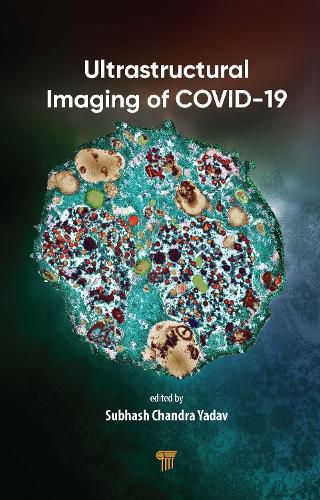 Cover image for Ultrastructural Imaging of COVID-19