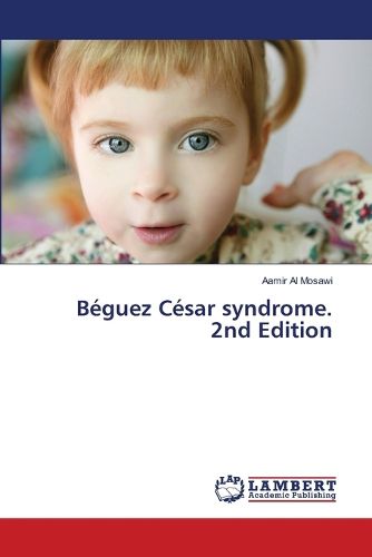 Cover image for Beguez Cesar syndrome. 2nd Edition
