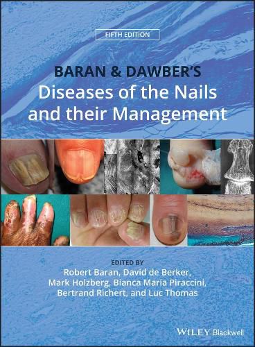 Baran & Dawber's Diseases of the Nails and their Management