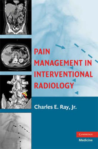 Cover image for Pain Management in Interventional Radiology