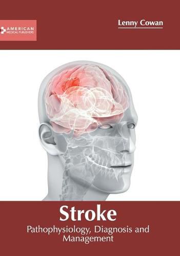 Cover image for Stroke: Pathophysiology, Diagnosis and Management