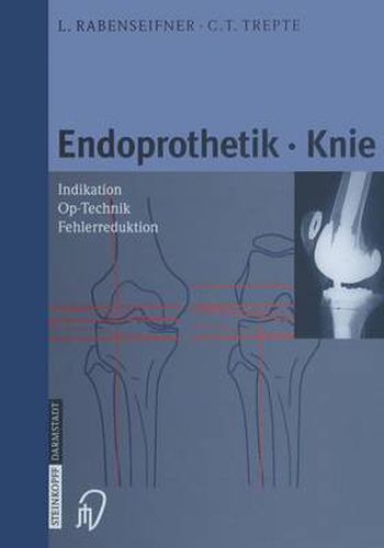 Cover image for Endoprothetik Knie