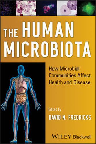 Cover image for The Human Microbiota: How Microbial Communities Affect Health and Disease