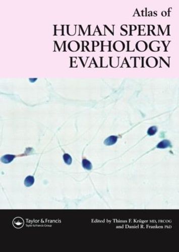 Cover image for Atlas of Human Sperm Morphology Evaluation