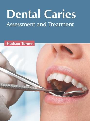 Cover image for Dental Caries: Assessment and Treatment