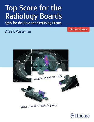 Cover image for Top Score for the Radiology Boards: Q&A for the Core and Certifying Exams