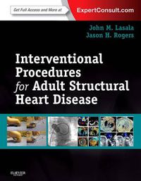 Cover image for Interventional Procedures for Adult Structural Heart Disease