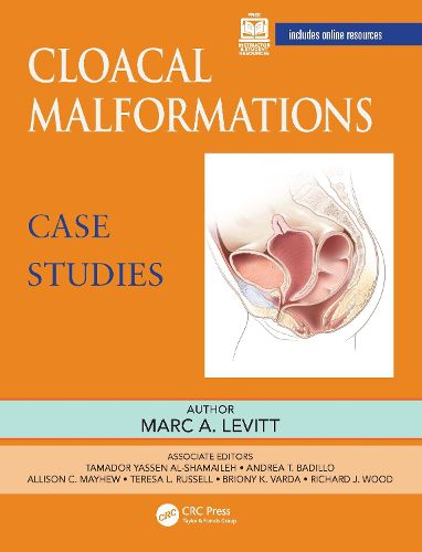 Cover image for Cloacal Malformations: Case Studies