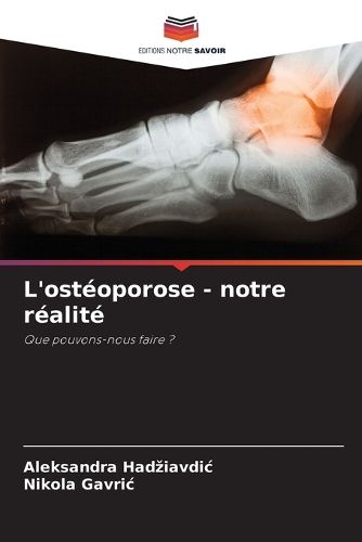 L'osteoporose - notre realite, Aleksandra Hadziavdic, Nikola Gavric ...
