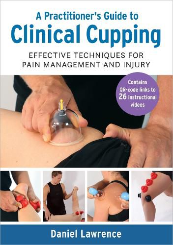 Cover image for A Practitioner's Guide to Clinical Cupping: Effective Techniques for Pain Management and Injury