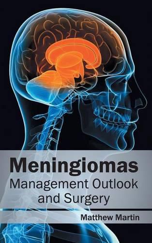 Cover image for Meningiomas: Management Outlook and Surgery