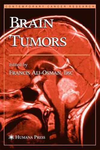 Cover image for Brain Tumors