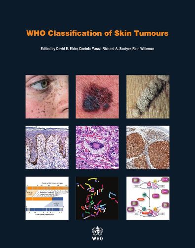 WHO Classification of Skin Tumours: WHO Classification of Tumours, Volume 11