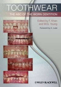 Cover image for Toothwear: The ABC of the Worn Dentition