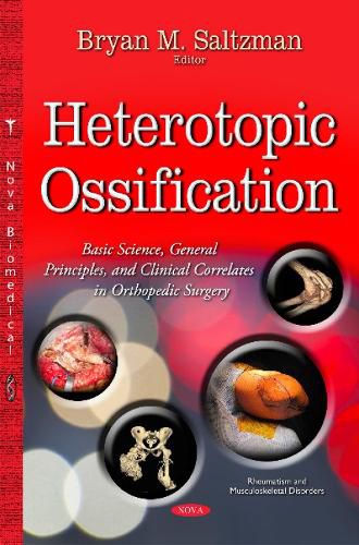 Cover image for Heterotopic Ossification: Basic Science, General Principles & Clinical Correlates in Orthopedic Surgery