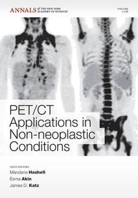 Cover image for PET CT Applications in Non-Neoplastic Conditions