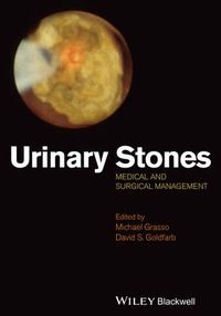 Cover image for Urinary stones - Medical and Surgical Management