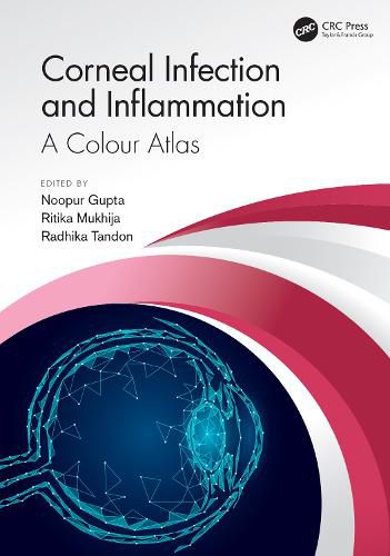 Cover image for Corneal Infection and Inflammation: A Colour Atlas