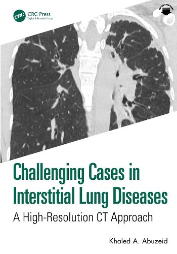 Cover image for Challenging Cases in Interstitial Lung Diseases