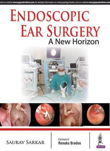 Cover image for Endoscopic Ear Surgery: A New Horizon