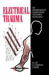 Cover image for Electrical Trauma: The Pathophysiology, Manifestations and Clinical Management