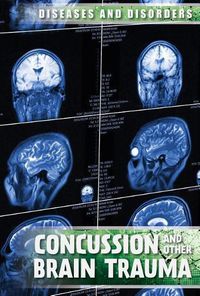 Cover image for Concussions and Other Brain Trauma