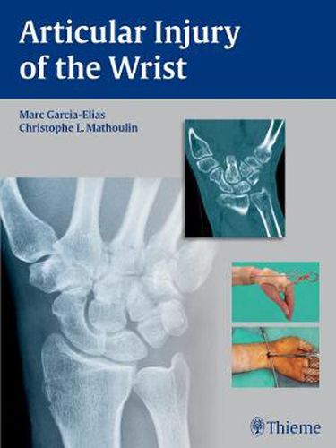 Cover image for Articular Injury of the Wrist: FESSH 2014 Instructional Course Book