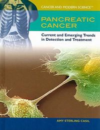 Cover image for Pancreatic Cancer