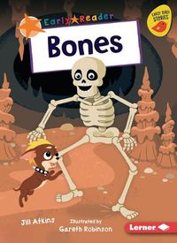 Cover image for Bones