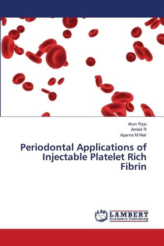 Cover image for Periodontal Applications of Injectable Platelet Rich Fibrin