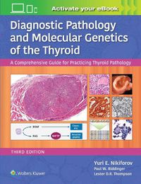 Cover image for Diagnostic Pathology and Molecular Genetics of the Thyroid: A Comprehensive Guide for Practicing Thyroid Pathology