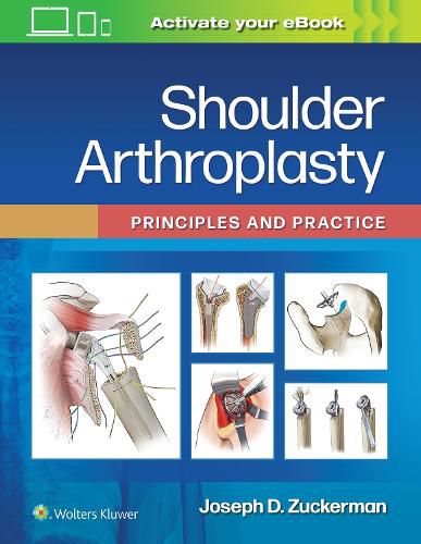 Cover image for Shoulder Arthroplasty: Principles and Practice