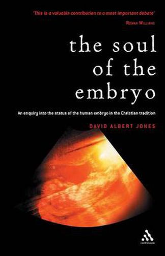 Cover image for Soul of the Embryo: Christianity and the Human Embryo