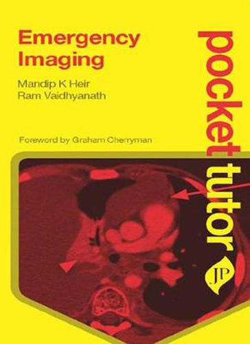 Cover image for Pocket Tutor Emergency Imaging